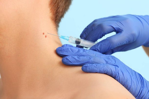 Dermatologue prenant la perforation taupe de jeune homme sur fond bleu, gros plan - Photo, image