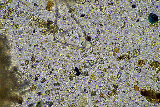 mikroskooppiset sienet ja mikro-organismit näytteessä Australiassa - Valokuva, kuva