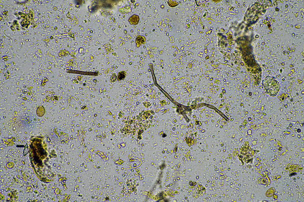 mikroskooppiset sienet ja mikro-organismit näytteessä Australiassa - Valokuva, kuva