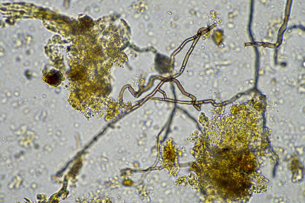 mikroskopické houby a mikroorganismy ve vzorku v Austrálii - Fotografie, Obrázek