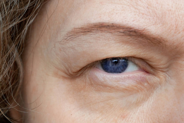 ženské oko středního věku s pokleslým víčkem a make-upem na obočí. Ptosis je svěšené horní víčko, líné oko. Kosmetika a obličejový koncept, první vrásky, detailní záběr - Fotografie, Obrázek