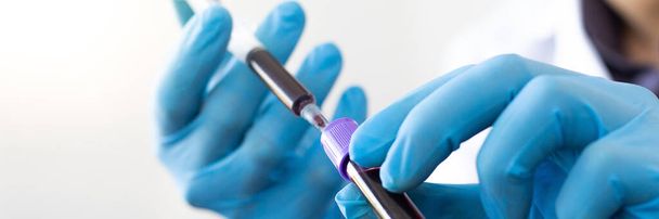 Scienziati o medici raccolgono campioni di sangue da nuovi ceppi di pazienti con virus per l'analisi e la vaccinazione nel laboratorio di ricerca, ricerca sul vaccino per eliminare il concetto di virus
. - Foto, immagini