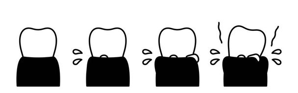 Ilustración de la progresión de la enfermedad periodontal imagen, dibujo de línea simple, ilustración vectorial - Vector, Imagen