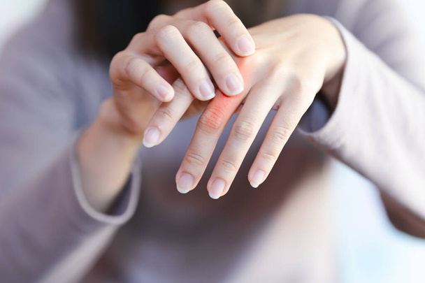 У женщины боли в суставах пальцев из-за ревматоидного артрита. Концепция здравоохранения. - Фото, изображение