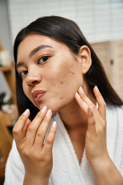 ritratto di giovane donna asiatica con acne toccare il viso e guardando la fotocamera, condizione della pelle - Foto, immagini