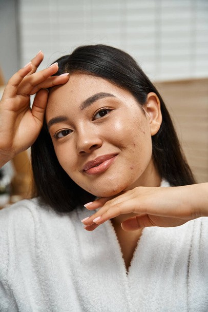portrait of happy young asian woman with acne touching face and looking at camera, skin care - Photo, Image