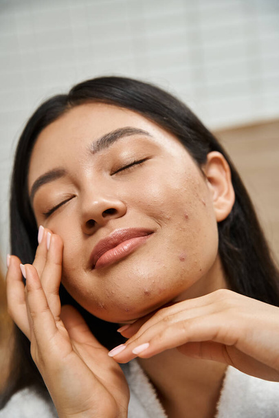 Porträt einer jungen und asiatischen Frau mit geschlossenen Augen und Akne, die ihr Gesicht berührt, Hautprobleme - Foto, Bild