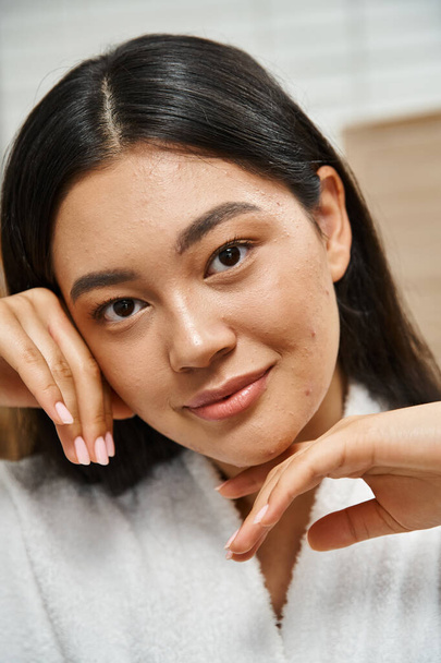close-up van gelukkig jong aziatisch vrouw met acne aanraken gezicht en kijken naar camera, huidverzorging - Foto, afbeelding