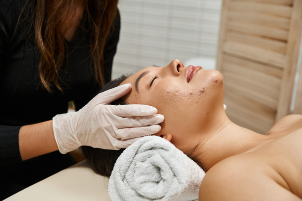 masaje facial para piel propensa al acné, masajista en guantes de látex y cliente asiático con los ojos cerrados - Foto, imagen
