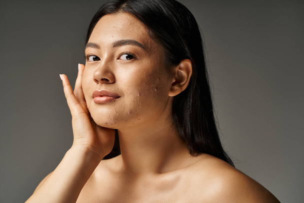 hübsche junge asiatische Frau mit Hautproblemen und nackten Schultern schaut in die Kamera auf grauem Hintergrund - Foto, Bild