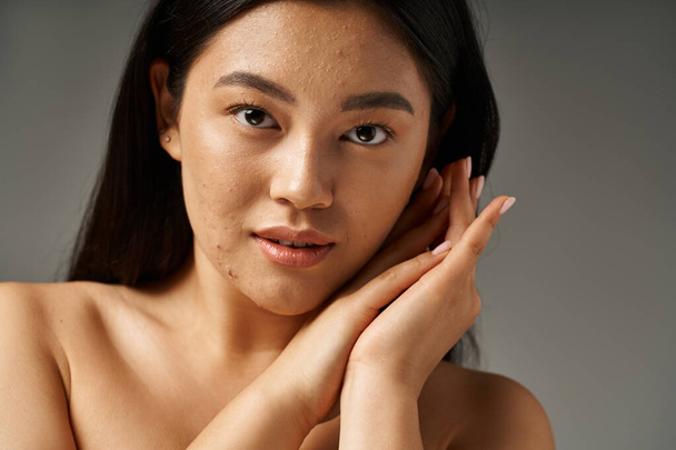 brunette young asian girl with skin issues and bare shoulders looking at camera on grey background - Photo, Image