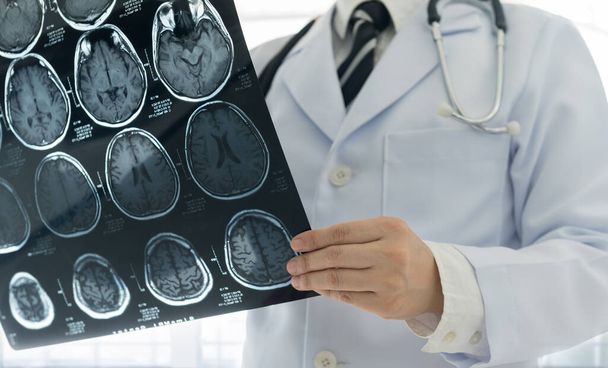 Arzt untersucht Röntgenfilm des Gehirns im Krankenhaus. - Foto, Bild
