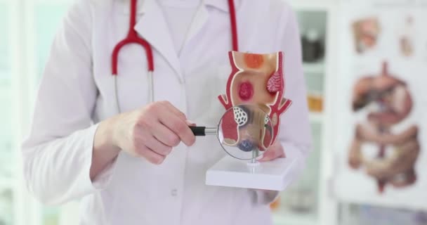 The doctor holds a magnifier and anatomical model of the anus. Search for hemorrhoids, conceptual medicine - Materiaali, video