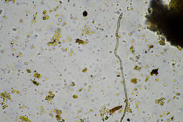 microorganismo del suelo bajo el microscopio que recicla nutrientes en un compost de una granja agrícola regenerativa en Australia, mostrando ameba, hongos, hongos, microbios y nematodos en primavera - Foto, imagen