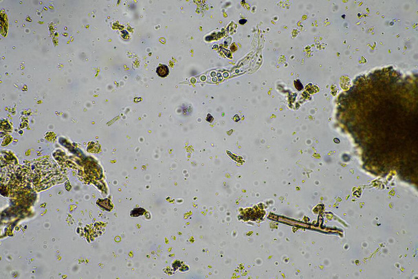 オーストラリアの再生農場で堆肥で栄養をリサイクルする顕微鏡下の土壌微生物は,春にアメバ,真菌,菌類,微生物,ネマトコを示しています - 写真・画像