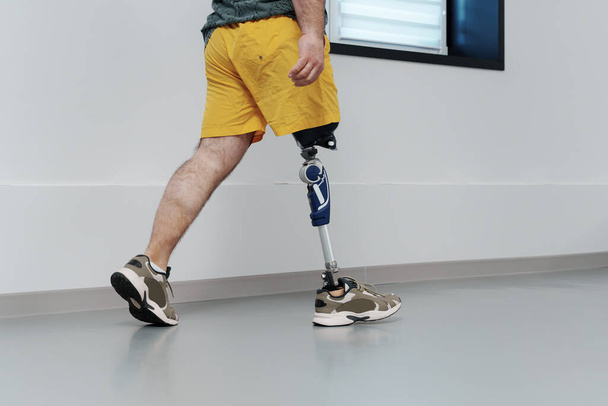 Sarı şortlu, protez bacaklı, tanınmayan bir erkek. Parlak geniş koridorda yürüyor. - Fotoğraf, Görsel