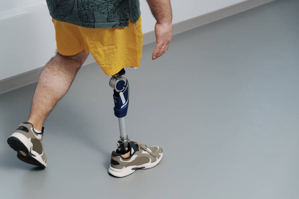 Een man stapt voorwaarts, toont de functionaliteit van zijn geavanceerde kunstbeen, symboliseert mobiliteit en onafhankelijkheid - Foto, afbeelding