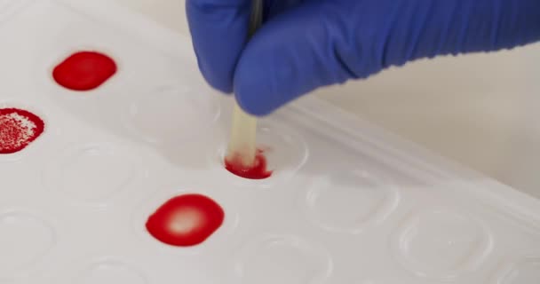 Teste de tipo sanguíneo e fator rh pelo método de aglutinação. Close-up em mãos de médico em luvas médicas fazendo pesquisa de microbiologia em laboratório. Determinação do grupo sanguíneo - Filmagem, Vídeo