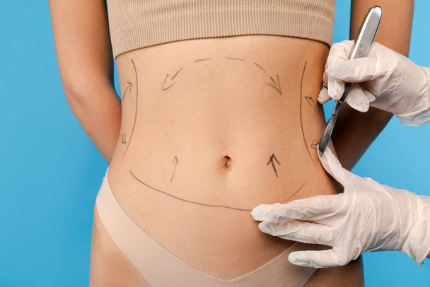 Detailní záběr plastického chirurga kreslí čáry na tělo mladé ženy. Izolované na modrém pozadí. Kosmetická péče, procedury proti stárnutí, koncepce plastické chirurgie - Fotografie, Obrázek