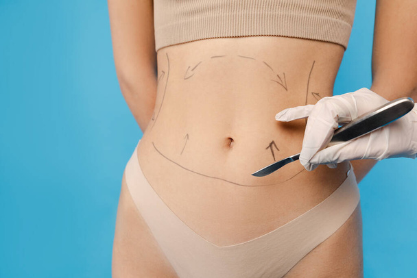 Молодая женщина в нижнем белье готовится к эстетическому лечению липоскульптуры. Изолированный на синем фоне. Косметика, антивозрастные процедуры, концепция пластической хирургии - Фото, изображение