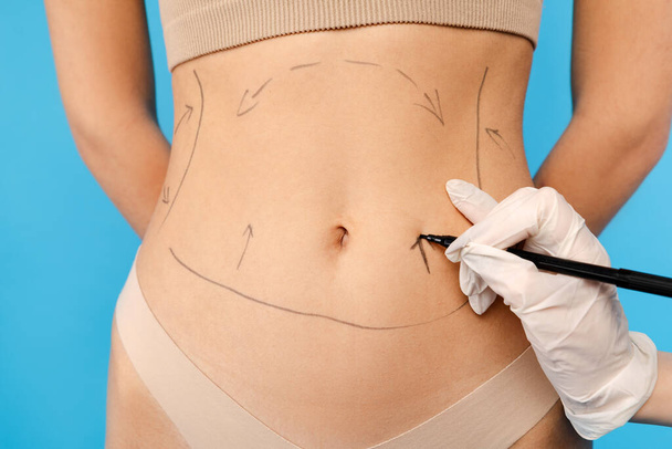 Πλαστικός χειρουργός χρησιμοποιώντας μαρκαδόρο στυλό, ενώ σήμανση κοιλιά μέρος του σώματος της γυναίκας. Απομονωμένο σε μπλε φόντο. Φροντίδα ομορφιάς, αντιγηραντικές διαδικασίες, πλαστική χειρουργική έννοια - Φωτογραφία, εικόνα