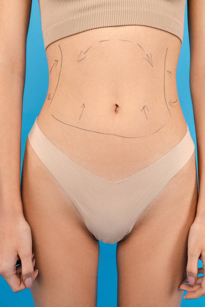 Καλλιεργημένη φωτογραφία γυναικείου σώματος με σημάδια στο σώμα. Απομονωμένο σε μπλε φόντο. Φροντίδα ομορφιάς, αντιγηραντικές διαδικασίες, πλαστική χειρουργική έννοια - Φωτογραφία, εικόνα