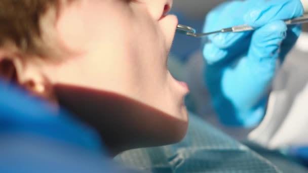 Φροντίδα γυναίκα οδοντίατρος χρησιμοποιώντας οδοντιατρική γωνία καθρέφτη, ενώ κάνει τερηδόνα κατάσταση σε ένα νεαρό ασθενή - Πλάνα, βίντεο