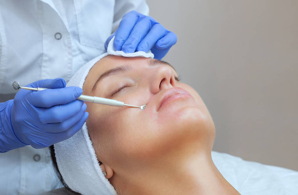 Procedimento para limpar a pele do rosto com um aparelho de aço com uma colher de cravos e acne. - Foto, Imagem