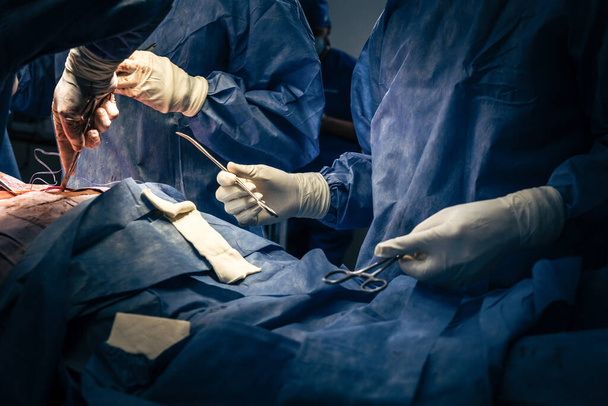 Chirurgen und Instrumentalassistenten führen in der Notaufnahme eines Krankenhauses einen chirurgischen Eingriff durch. Ein Assistent reicht den Chirurgen während der Operation Scheren und Instrumente. - Foto, Bild