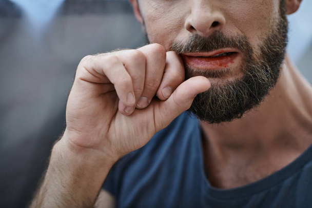 bijgesneden beeld van angstige man met baard bijten zijn lippen tot bloed tijdens depressieve episode - Foto, afbeelding
