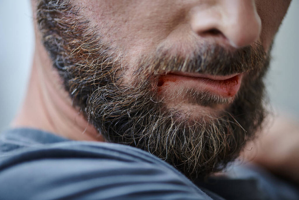 bijgesneden beeld van angstige man bijten zijn lippen tot bloed tijdens depressieve episode, geestelijke gezondheid - Foto, afbeelding