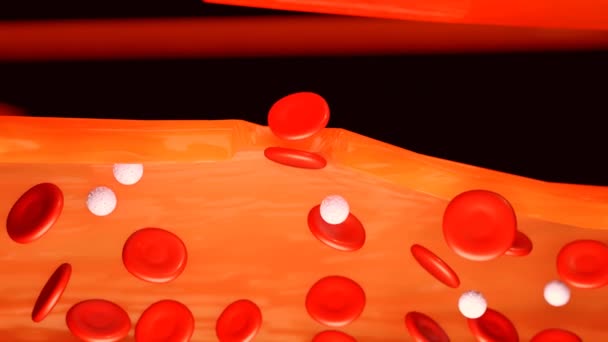 3D animation της αιμορροφιλίας οδηγεί σε αυτόματη αιμορραγία, καθώς και αιμορραγία μετά από τραυματισμούς ή χειρουργική επέμβαση  - Πλάνα, βίντεο
