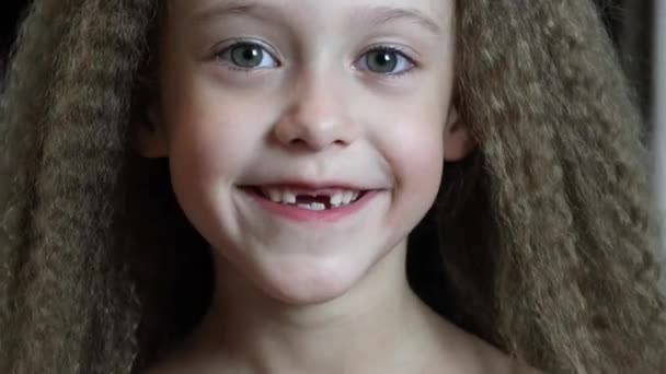 Χαριτωμένο κοριτσάκι χαμογελάει και δείχνει τα πεσμένα μπροστινά δόντια της. Αύξηση δοντιών. Κοντινό πλάνο. Πορτραίτο ενός 6χρονου ρεμπέκ. - Πλάνα, βίντεο