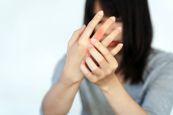 La mujer tiene dolor en las articulaciones de los dedos debido a la artritis reumatoide. Concepto de salud. - Foto, imagen