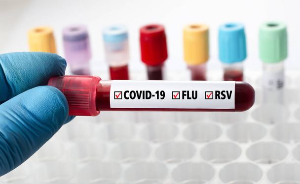 blood sample labeled with covid-a9, flu and rsv virus. Triplemedic sample. Coronavirus, Flu A, B, and Respiratory Syncytial Virus.  - Zdjęcie, obraz