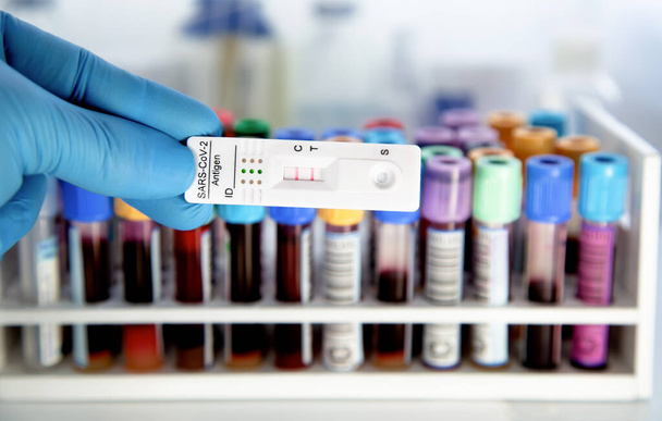 test Cassette for Covid 19 variant included Pirola BA.2.86. Blood tubes test in background. Antigen test kit for SARSCoV2 self testing  - Foto, Imagem