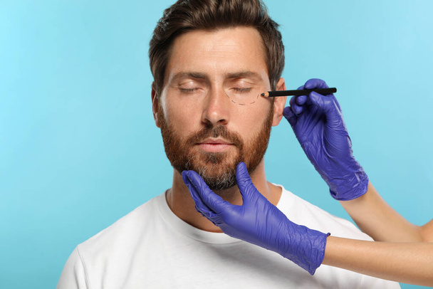 Doctor with pencil preparing patient for cosmetic surgery operation on light blue background, closeup - 写真・画像
