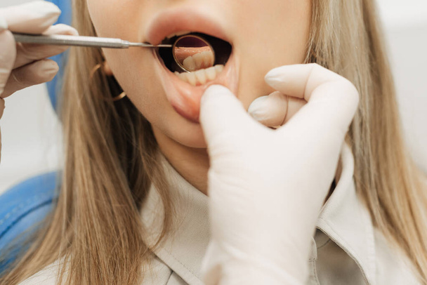 zbliżenie. Dentysta bada zęby pacjenta. - Zdjęcie, obraz