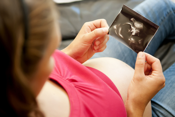 Беременная женщина с ультразвуковой картиной
 - Фото, изображение
