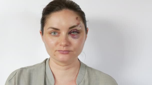 Ein großes echtes Bluterguss-Hämatom unter dem Auge einer jungen Frau, frische violette Prellungen und Kratzer an der Stirn durch einen Schlag. verängstigtes Gesicht des Opfers häuslicher Gewalt Nahaufnahme weißen Hintergrund - Filmmaterial, Video