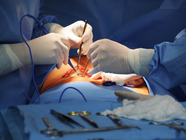 chirurgische ingreep - Foto, afbeelding