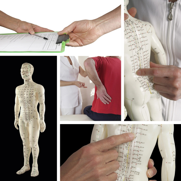 Obtener un tratamiento de acupuntura para el collage de dolor de espalda
 - Foto, imagen