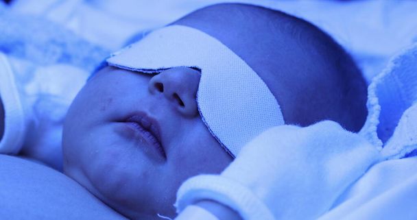 Newborn baby boy under phototherapy lamp. getting treated for jaundice - Foto, Imagen