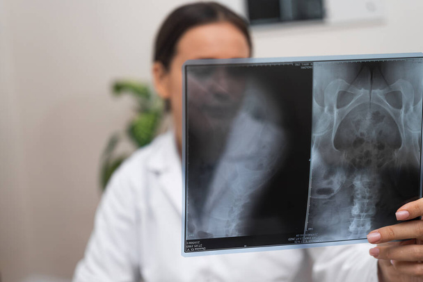 Tanı Radyografisi: Hastanede bir doktor, tıbbi sağlık hizmetlerinin bir parçası olarak radyolojik bir röntgen filmi kullanarak hastaların hastalıkları hakkında bir teşhis değerlendirmesi yapıyor. - Fotoğraf, Görsel