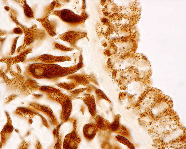 Nagy nagyítású fénymikroszkóp mikrográf egy foltmentes írisz hátsó felületén, amely a pigmentsejtek lokalizációját mutatja. A melanin pigment koncentrálódik a hátsó felületén az írisz stroma, és a pigment epithelium (jobb). Között - Fotó, kép