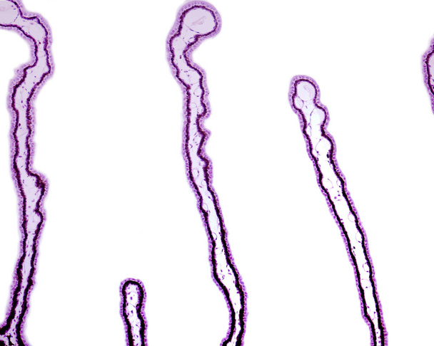 Ciliair lichaam. Geïsoleerde ciliaire processen die duidelijk de dubbele epitheellaag, het niet-gepigmenteerde innerlijke epitheel en het gepigmenteerde epitheel tonen. - Foto, afbeelding