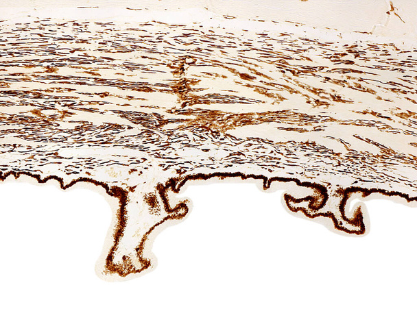 Onbevlekt ciliair lichaam (pars plicata) dat de plaats van pigment in de plooien of ciliaire processen (inwendig gepigmenteerd epitheel) en het ciliair lichaamstrima aangeeft. - Foto, afbeelding