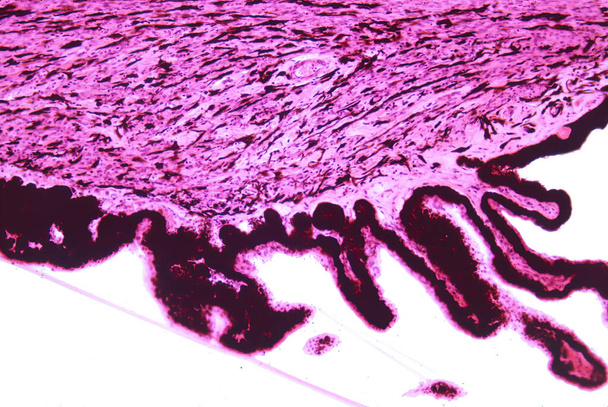 Человеческое цилиарное тело. Сверху строма цилиарного тела, показывающая кровеносные сосуды и пигментированные клетки, полные гранул меланина и несколько цилиарных процессов, выстланных двойным эпителиальным слоем, непигментированным внутренним эпителием и пигментированным эпителием. Fi - Фото, изображение