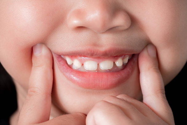 Zbliżenie uroczej Azjatki wskazującej palcem na kącik ust i uśmiechającej się szczęśliwie pokazując przednie zęby. Szczęśliwa koncepcja życia - Zdjęcie, obraz