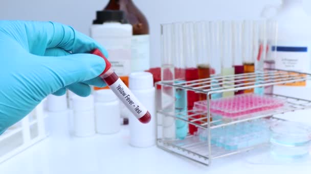 Jaune Test de fièvre pour rechercher des anomalies du sang, expérience scientifique - Séquence, vidéo